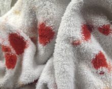 how to remove blood stains from a towel