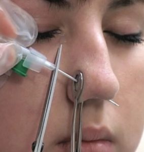 piercing operation