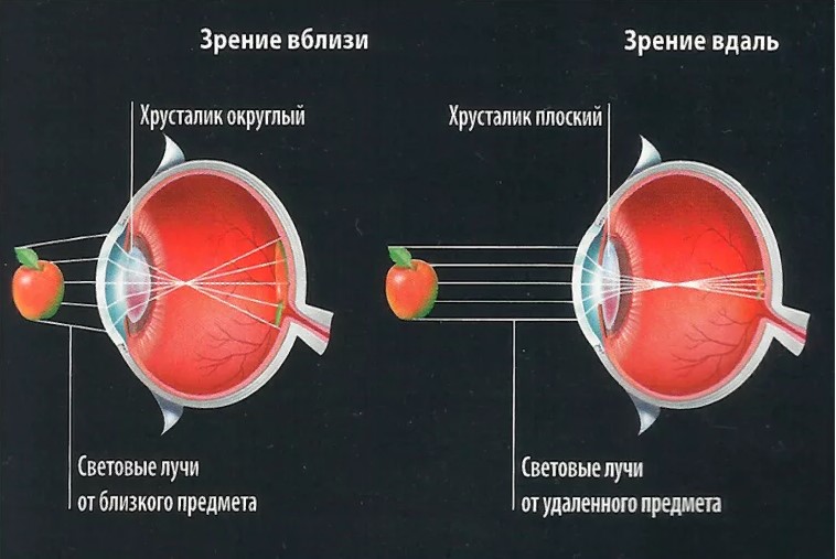 visión 3