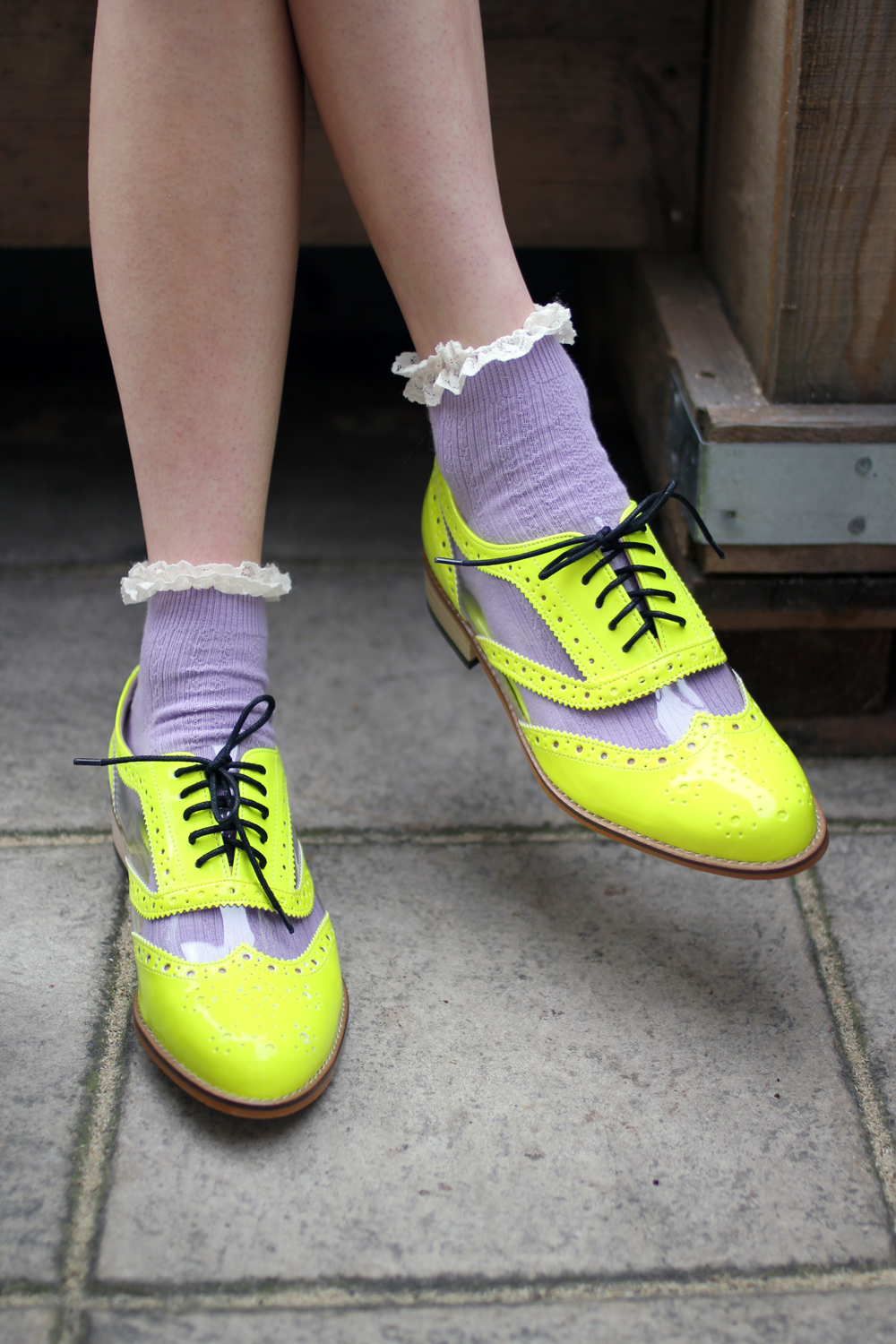 scarpe al neon