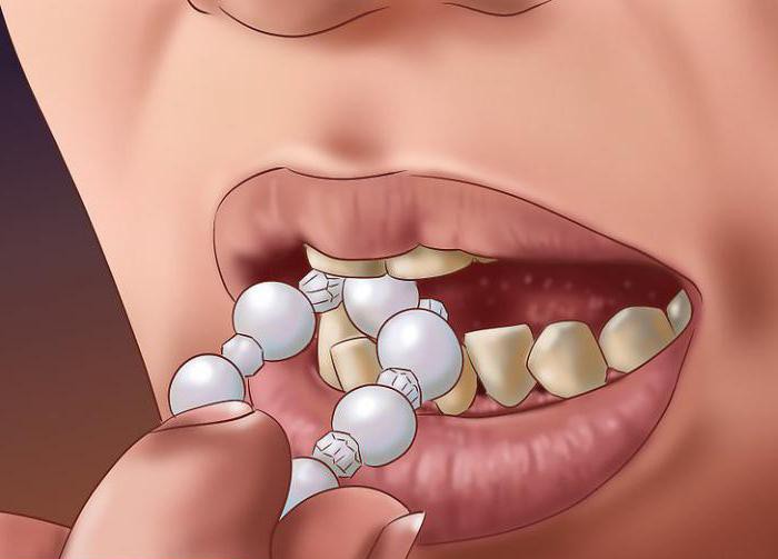 vérification des dents