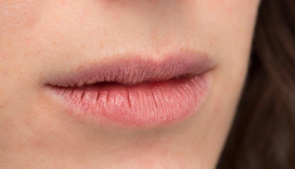 Labios secos.